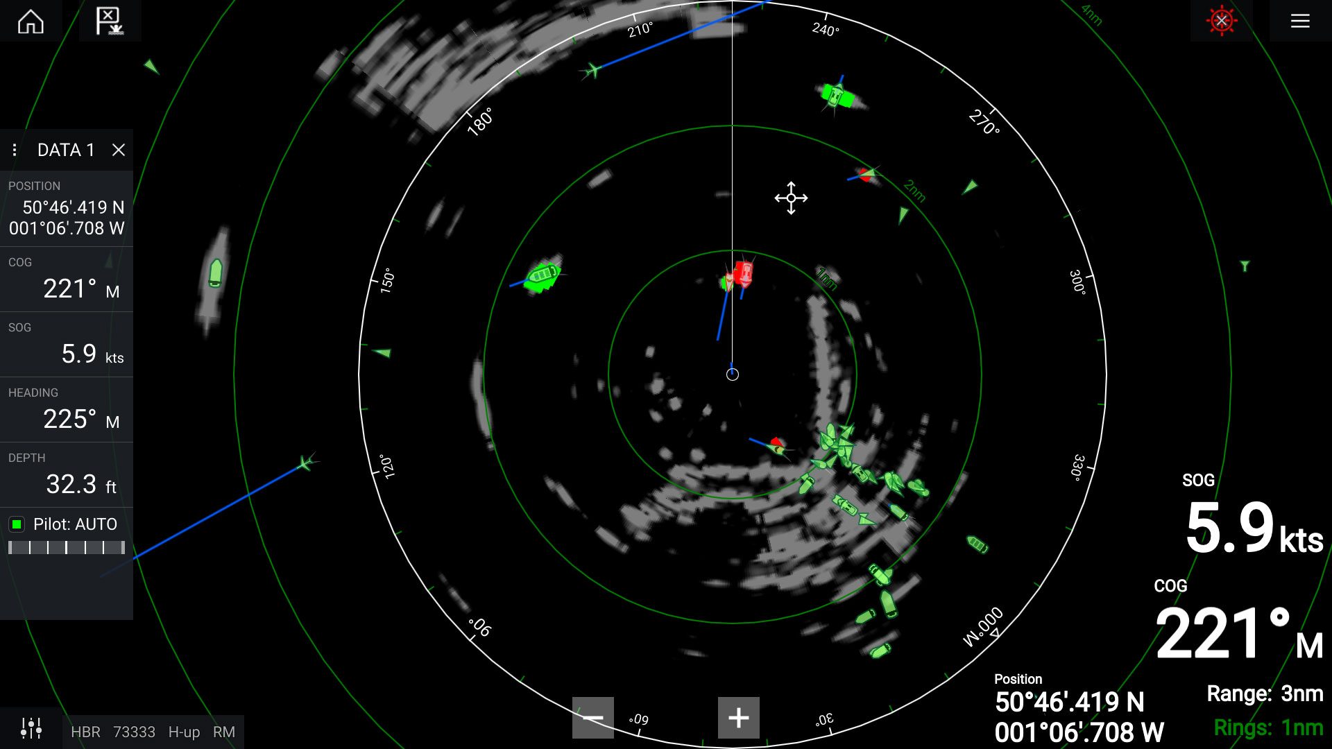 Radar Doppler